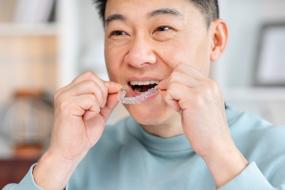 A man gently places a clear aligner over his teeth, demonstrating the ease and comfort of using transparent orthodontic trays for a straighter smile – Invisalign in Highlands.