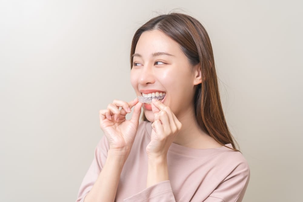 A young woman smiles as she gently fits a clear dental retainer onto her teeth, demonstrating proper use for maintaining a straight smile. - Retainers
