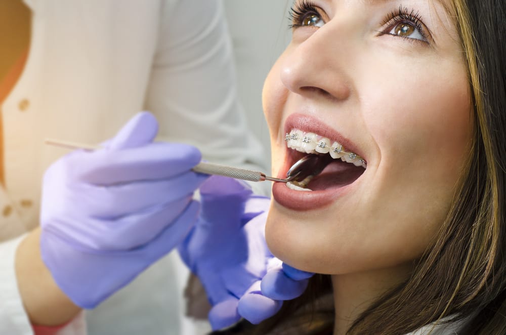 Orthodontic Checkup with Patient Wearing Braces – Braces in Denver A patient with metal braces receives a professional orthodontic examination, highlighting the importance of routine checkups in achieving optimal alignment and long-term oral health – Braces in Denver.